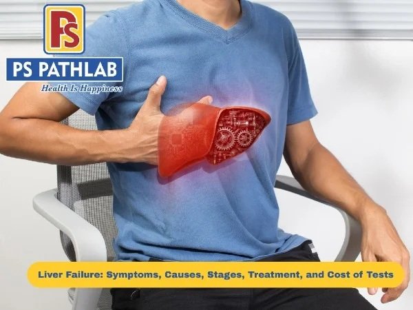 Liver Failure: Symptoms, Causes, Stages, Treatment, and Cost of Tests