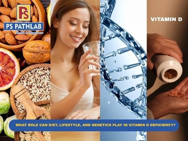 What Role Can Diet, Lifestyle, and Genetics Play in Vitamin D Deficiency?
